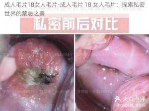 成人毛片18女人毛片-成人毛片 18 女人毛片：探索私密世界的禁忌之美