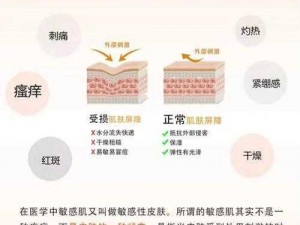 关于成吉思汗敏感皮肤保护的深入探讨与启示