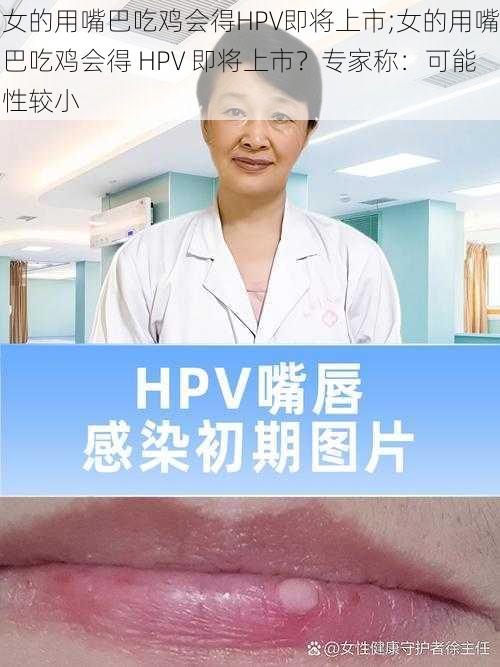 女的用嘴巴吃鸡会得HPV即将上市;女的用嘴巴吃鸡会得 HPV 即将上市？专家称：可能性较小